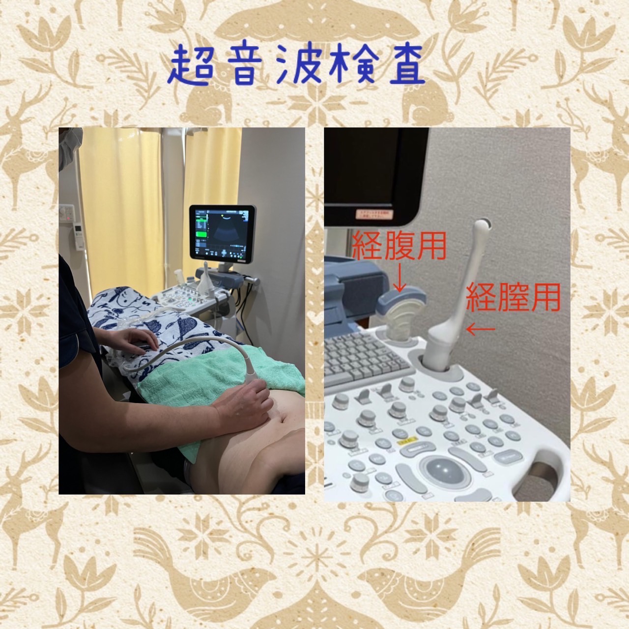 腹部 エコー 女性